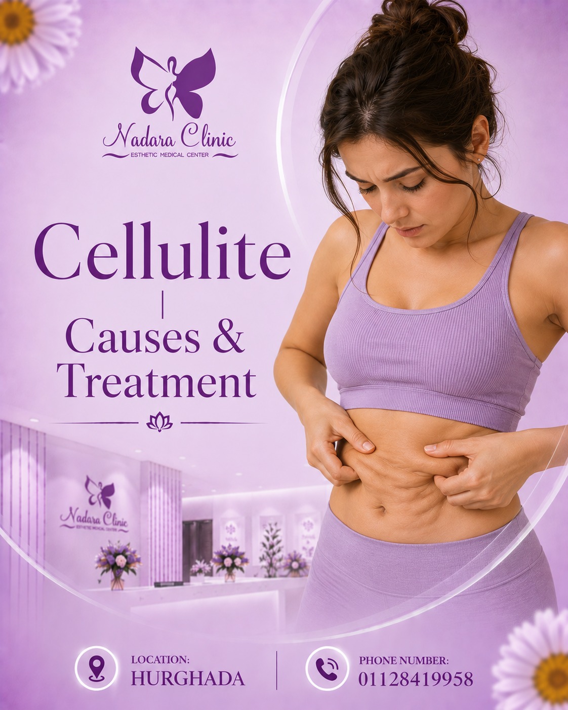 Cellulite: Causes and Ways to Get Rid of It in Hurghada